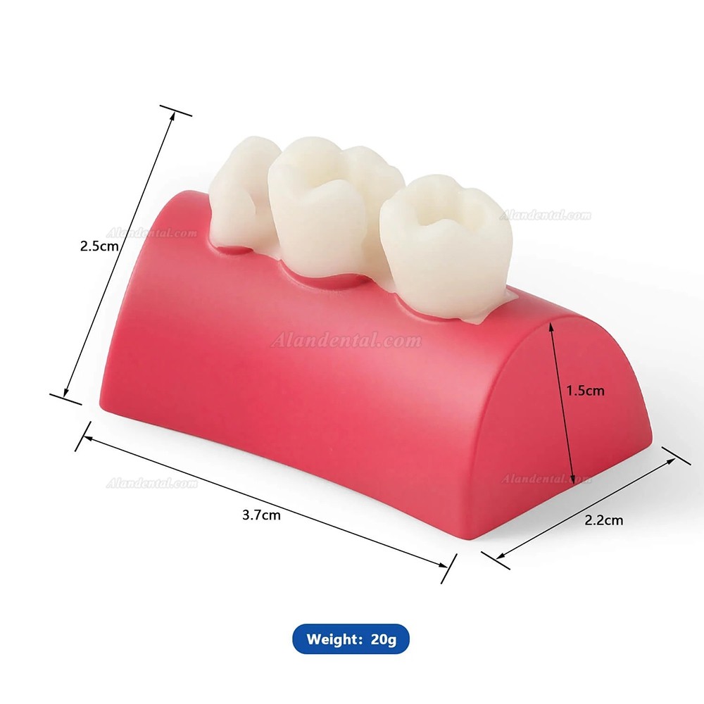 Dental Inlay Exercise Block Composite Resin Filling Teeth